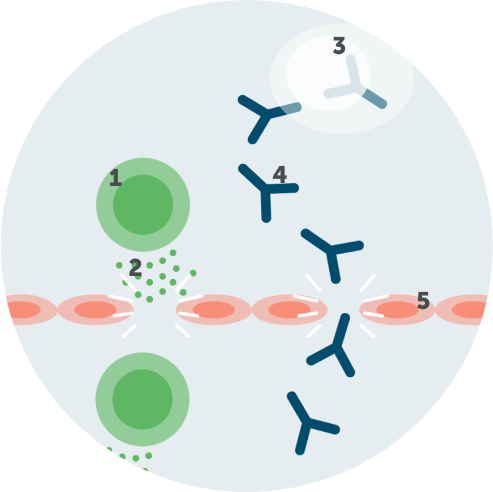 Depiction of the two ways that IgG autoantibodies have been shown to contribute to disease progress in CIDP.